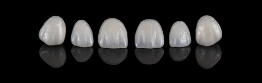 Dental Crowns